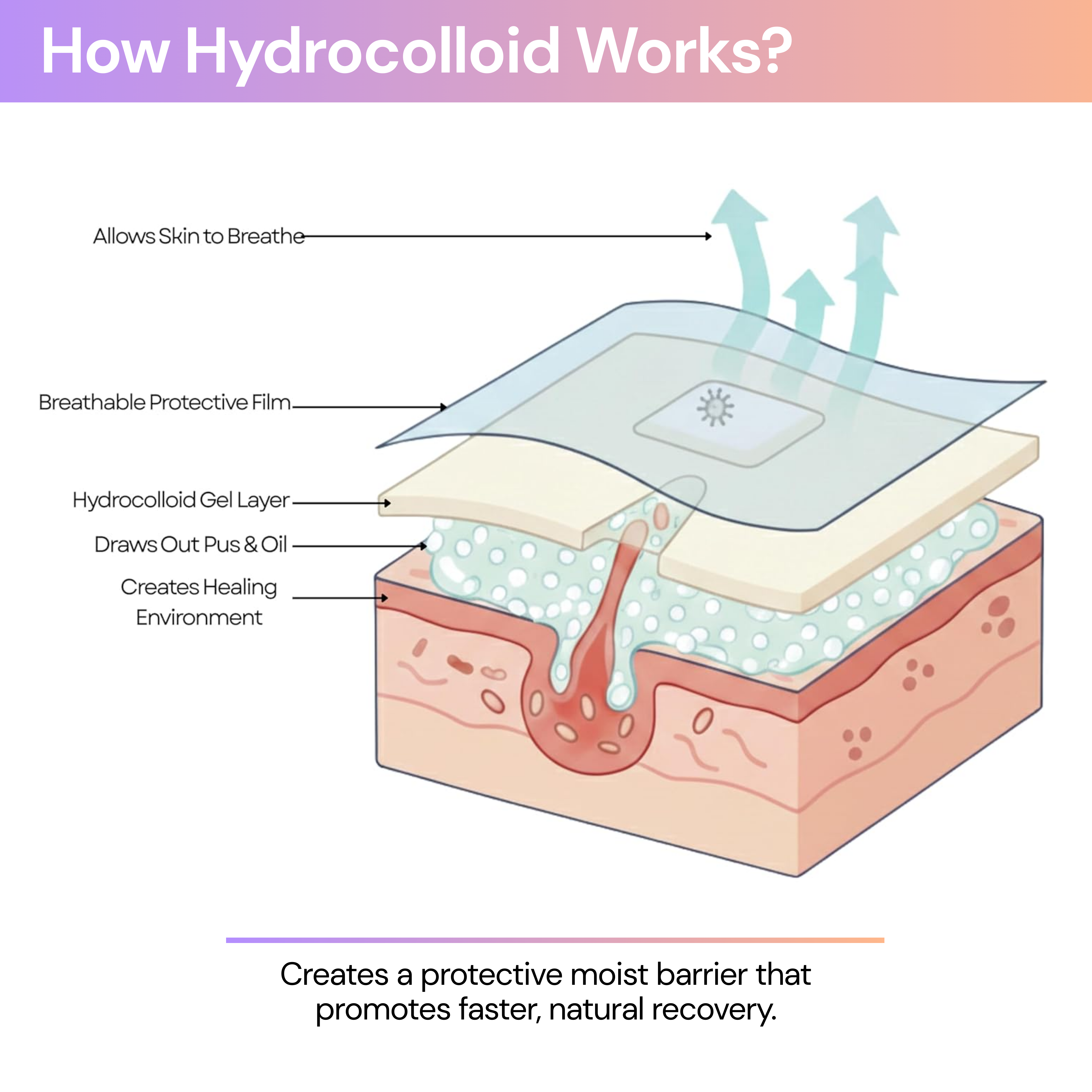 Medical Grade Hydrocolloid Dressing Roll
